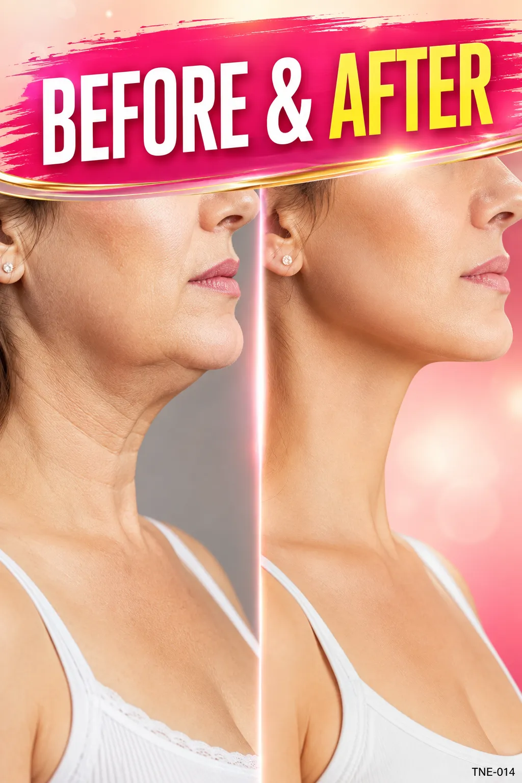 Skin Firming
